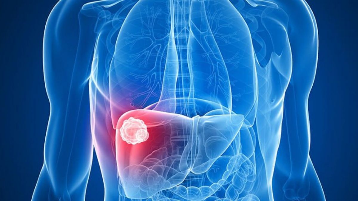 Các liệu pháp điều trị và chẩn đoán ung thư gan