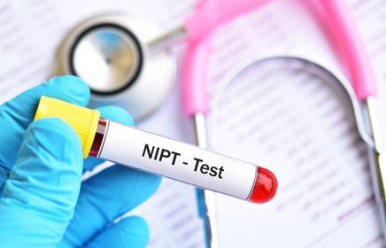 GIẢI PHÁP SÀNG LỌC CÁC BỆNH DI TRUYỀN TRƯỚC SINH KHÔNG XÂM LẤN (NIPT) BẰNG CÔNG NGHỆ GIẢI TRÌNH TỰ GEN THẾ HỆ MỚI NGS-ILLUMINA