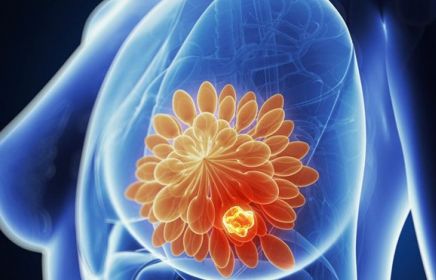 ỨNG DỤNG CÔNG NGHỆ GIẢI TRÌNH TỰ GEN THẾ HỆ MỚI NGS-ILLUMINA TRONG SÀNG LỌC UNG THƯ VÚ, UNG THƯ BUỒNG TRỨNG DO ĐỘT BIẾN GEN BRCA1/2