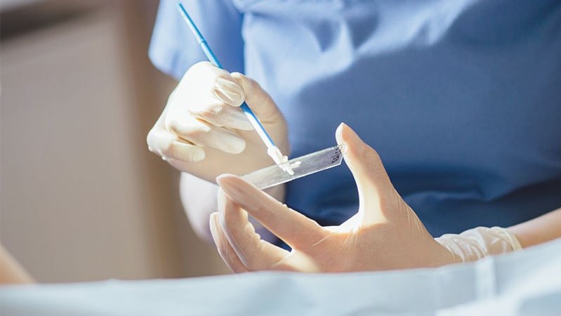 Thông báo tuyển sinh khóa học “Nhuộm soi bệnh phẩm dịch âm đạo phát hiện tác nhân gây bệnh” tháng 6,7/2022